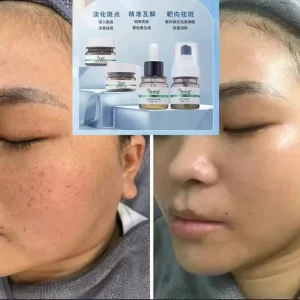 淡斑精华液